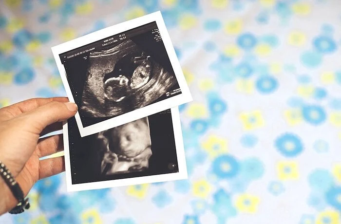 Верховный суд Джорджии восстановил «Закон о сердцебиении», запрещающий аборты после 6-й недели берем Верховный суд Джорджии восстановил «Закон о сердцебиении», запрещающий аборты после 6-й недели берем