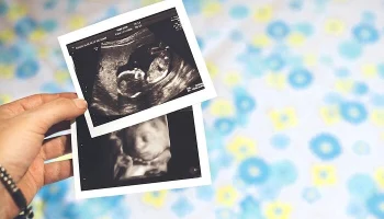 Верховный суд Джорджии восстановил &laquo;Закон о сердцебиении&raquo;, запрещающий аборты после 6-й недели берем